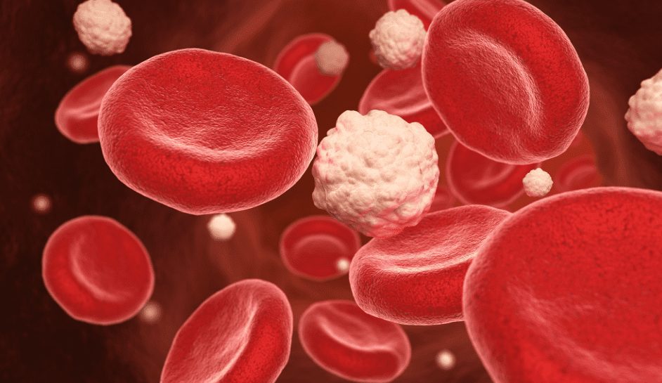 Sugary foods that can slow healing during surgery recovery